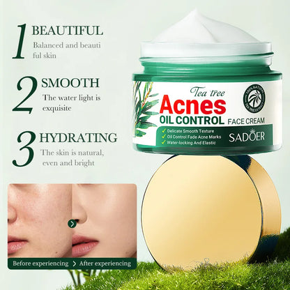 Tea Tree Acne Removing Face Cream Anti Acne