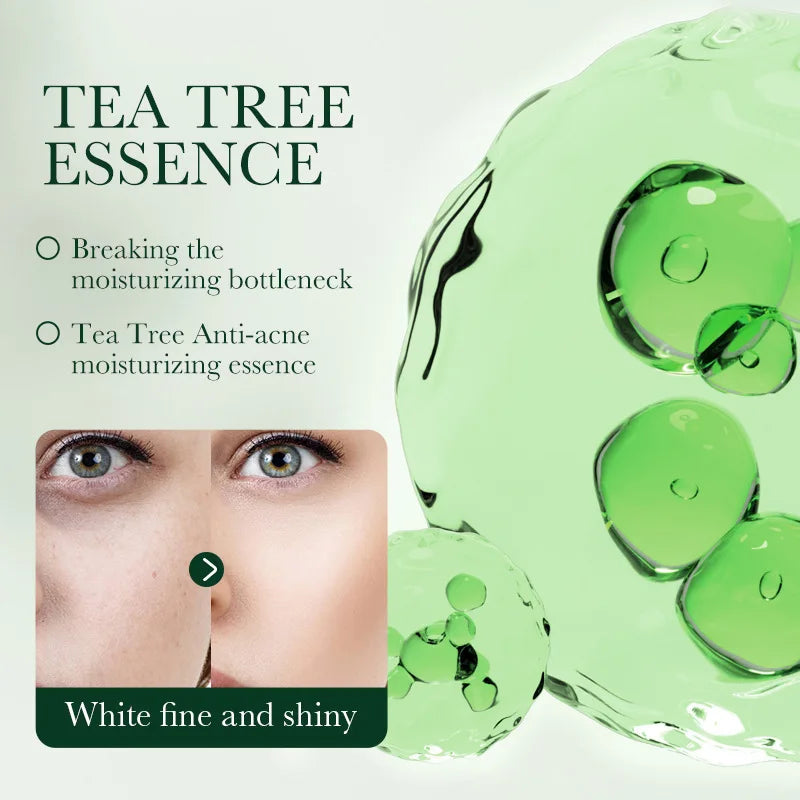 Tea Tree Acne Removing Face Cream Anti Acne
