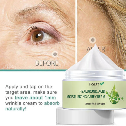 Instant Remove Wrinkles Retinol Face Cream Lifting Anti